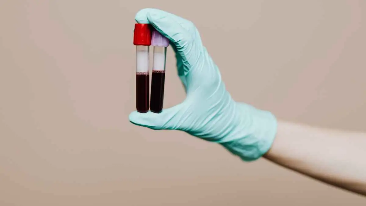 Why Routine Health Checkups Matter for Everyone